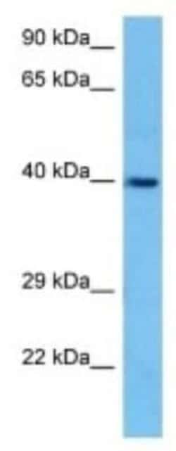 Hsd3b5 Rabbit anti-Mouse, Polyclonal, Novus Biologicals:Antibodies:Primary